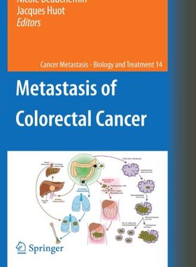 【预订】Metastasis of Colorectal Cancer
