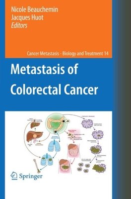 【预订】Metastasis of Colorectal Cancer