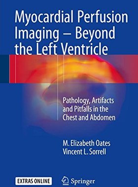 【预订】Myocardial Perfusion Imaging - Beyon...