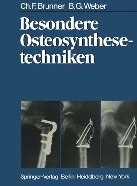 【预订】Besondere Osteosynthesetechniken