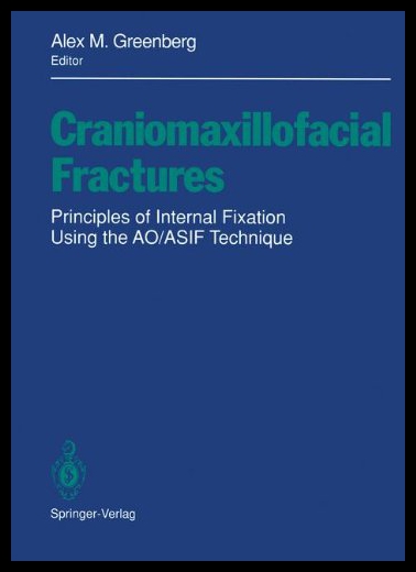 【预售】Craniomaxillofacial Fractures: Principles of Inte