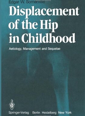 【预售】Displacement of the Hip in Childhood: Aetiology, ...