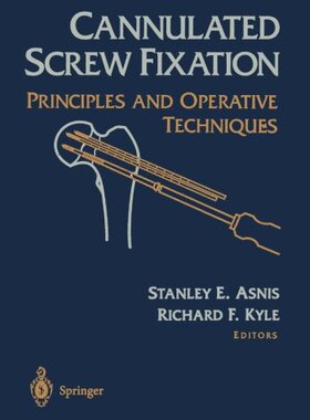 【预订】Cannulated Screw Fixation: Principle...