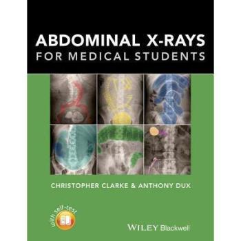 【预订】Abdominal X-Rays for Medical Students
