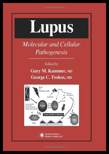 【预售】Lupus: Molecular and Cellular Pathogenesis