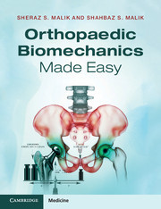 【预订】Orthopaedic Biomechanics Made Easy