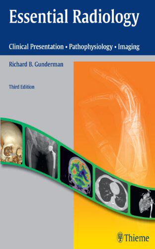 【预售】Essential Radiology: Clinical Presentation, Pa...