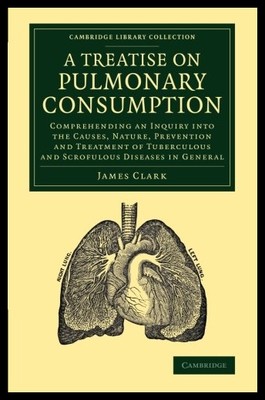 【预售】A   Treatise on Pulmonary Consumption: