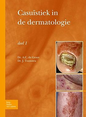 【预订】Casuistiek in de Dermatologie Deel I