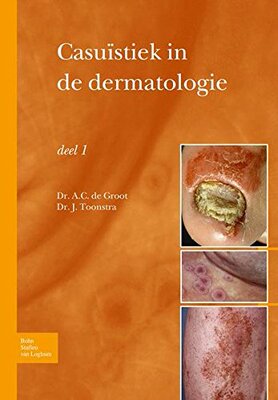 【预订】Casuistiek in de Dermatologie Deel I