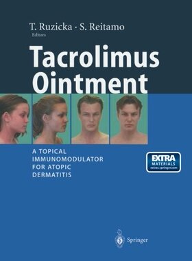 【预订】Tacrolimus Ointment