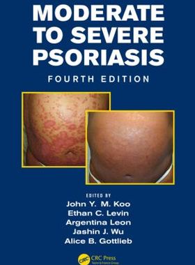 【预售】Moderate to Severe Psoriasis, Fourth Edition