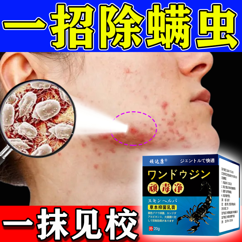 男士去角质毛孔粗大粉刺黑头螨虫药膏吸螨虫神器脸部背部去螨神器