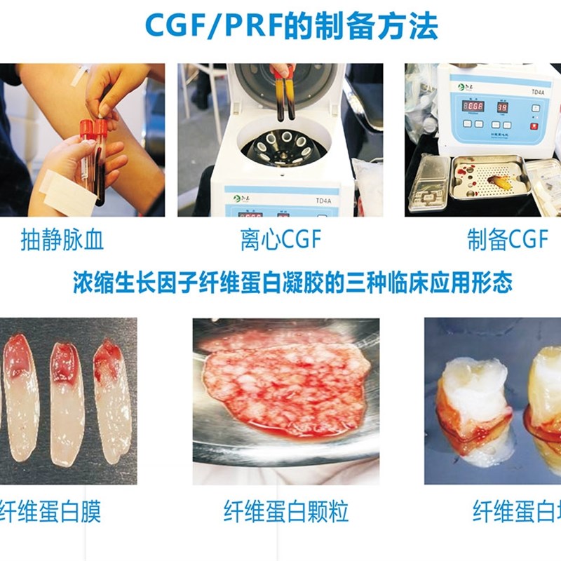 推荐压膜器 PRF 血小板 CGF 离心机 压膜工具 口腔牙科进口种植器