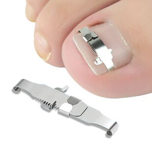 Care Toenai Tool Professional Foot Set Ingrown 速发Corrector