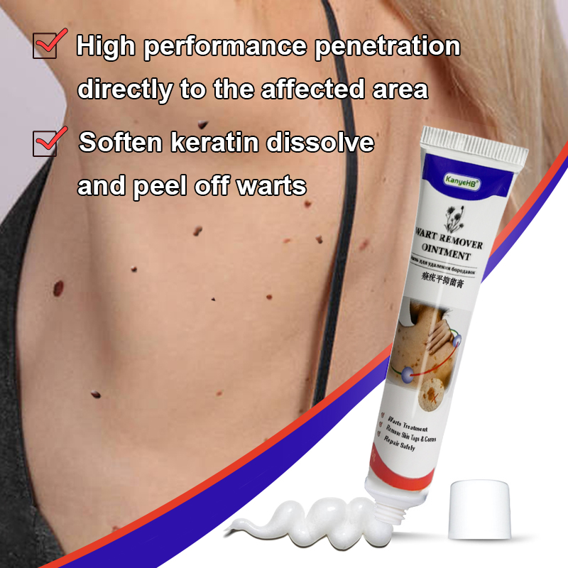 新品Warts Remover Ointment Wart Treatment Cream Skin Tag Rem