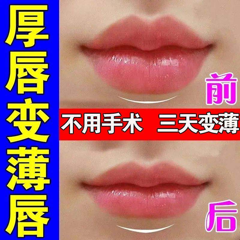 嘴唇变薄变小嘴巴厚外翻淡化唇纹黑色素瘦嘴唇发黑外翻矫正神器