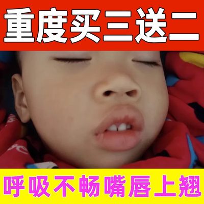 急速发货【医师推荐】腺样体肥大中药贴儿童睡觉张嘴打呼鼻塞腺样