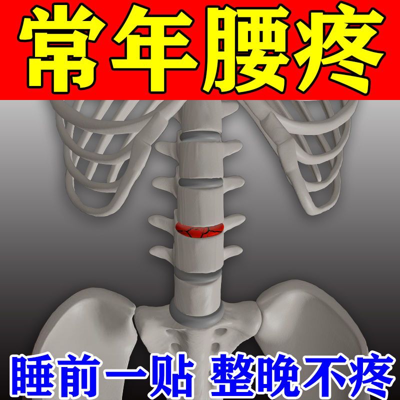 腰疼腰痛专用g贴压迫神经导致腰疼腿疼脚麻弯不下腰膏贴