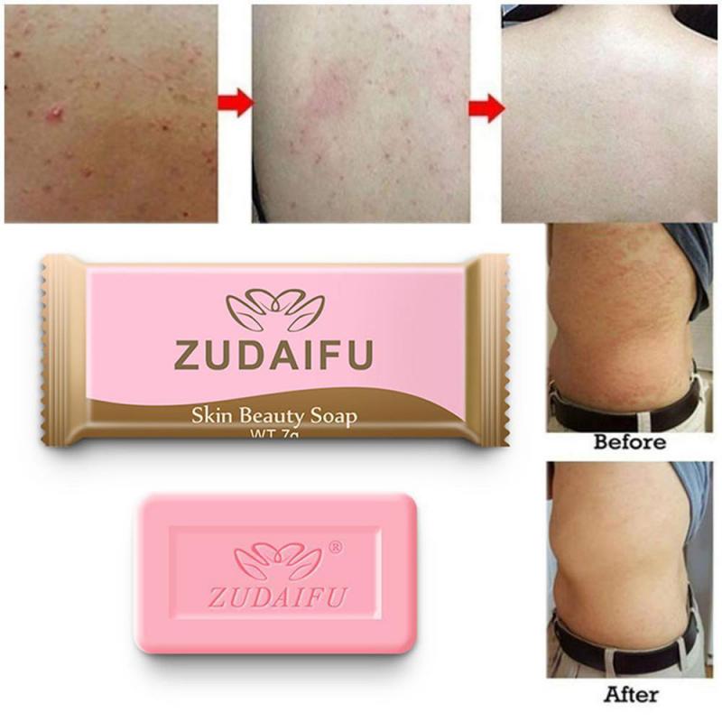 网红.Antibacterial Anti Fungus Bath Sulfur Soap Body Whiteni