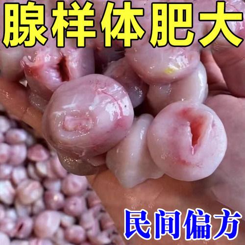 热销腺样体肥大面容纠正器专调理儿童张嘴呼吸不通气腺样体中药贴