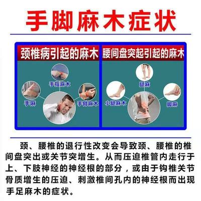 网红手麻专用药【一喷止麻】手脚麻木疼痛胳膊麻压迫神经风湿喷剂