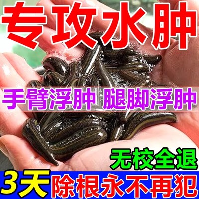 极速【消水肿100%】利尿排水肿老人下肢腿部脸部全身浮肿水肿消肿