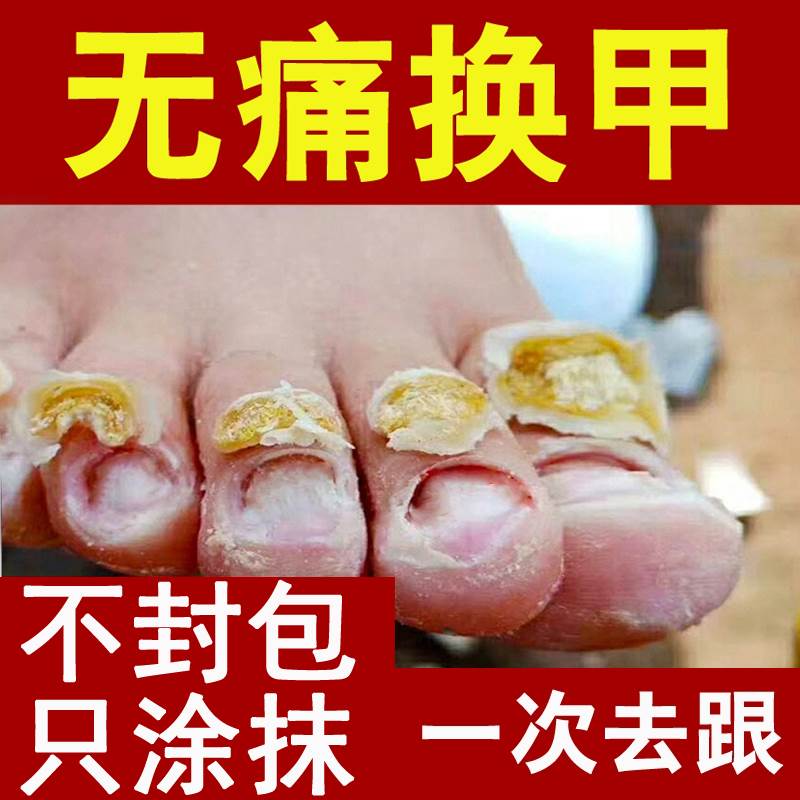 极速脱甲液去坏指甲增厚无痛精油脱甲膏软甲液抑菌液灰甲净专用指