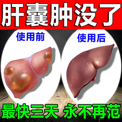 速发肝囊肿治疗正品多发性肝囊肿去除肾囊消肿方神器舒肝养肝的中