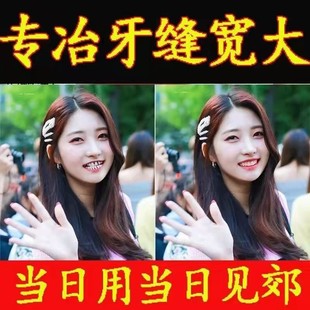 牙齿缝隙大有洞自己补遮盖填充假门牙一颗矫正器神器临时牙套修复