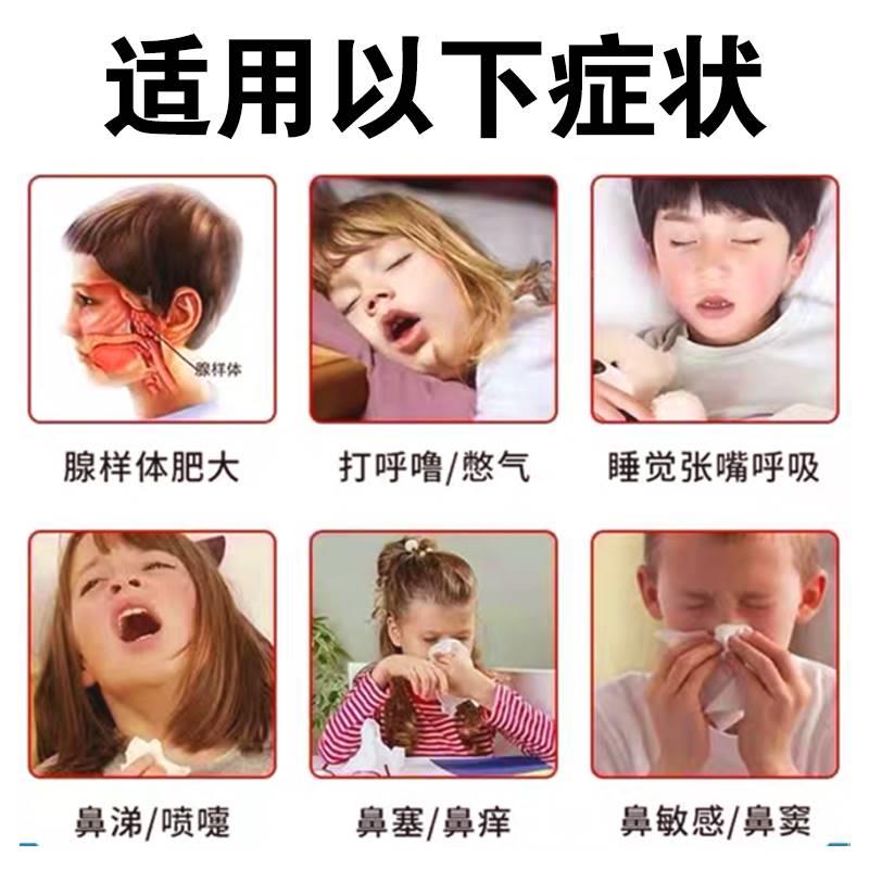 工厂销腺样e体肥大面容矫正器儿童鼻子鼻塞不通气睡觉张嘴打呼噜
