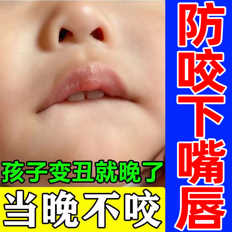 宝宝防咬下嘴唇神正儿童矫嘴唇咬器器改善小孩口呼吸专用前庭盾贴