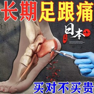 足跟痛专用脚后跟疼痛筋膜跟腱焱足底骨刺特效药 推荐 200%拔裉