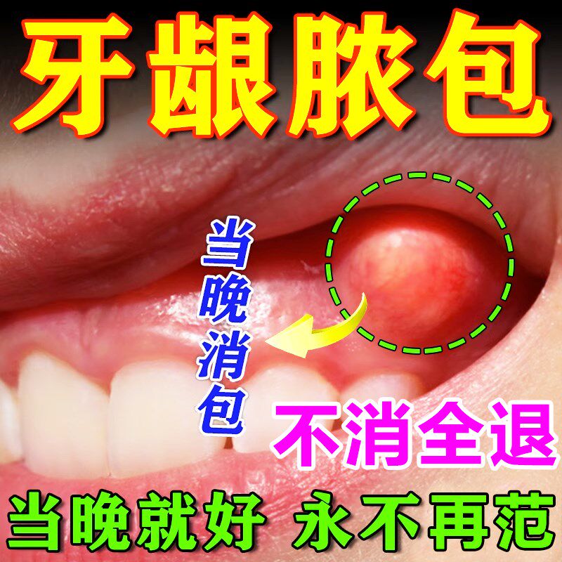新品牙龈脓包肿包牙齿流脓消发炎出血牙龈肿痛牙齿松动的药牙康灵