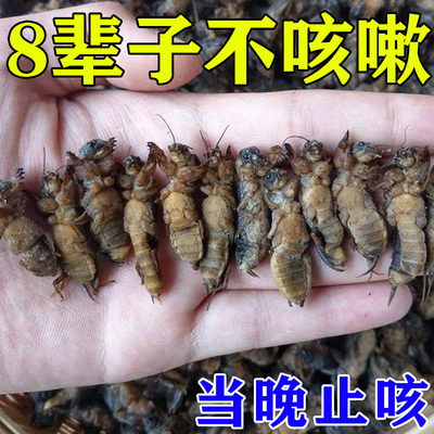 速发10倍渗透冶咳嗽】咳喘贴大人儿童咳嗽干咳过敏性咳嗽化痰润肺