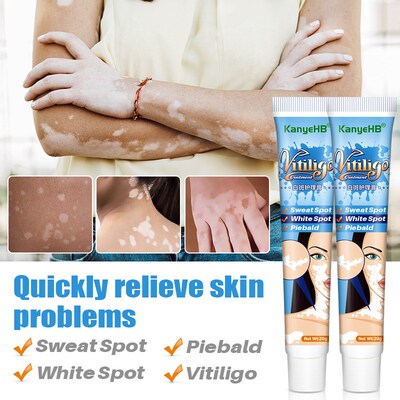 5Pcs 20g Herbal Extract Vitiligo Ointment Remove Ringworm Wh