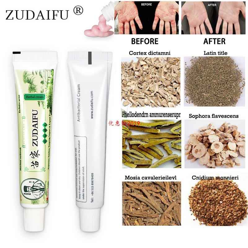 极速100% Originale zudaifu Della Pelle Psoriasi Crema Dermat