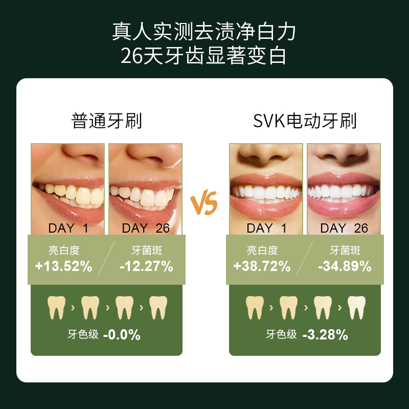 svk电动d牙刷全自动智能防水成人软毛刷头声波充电式男女