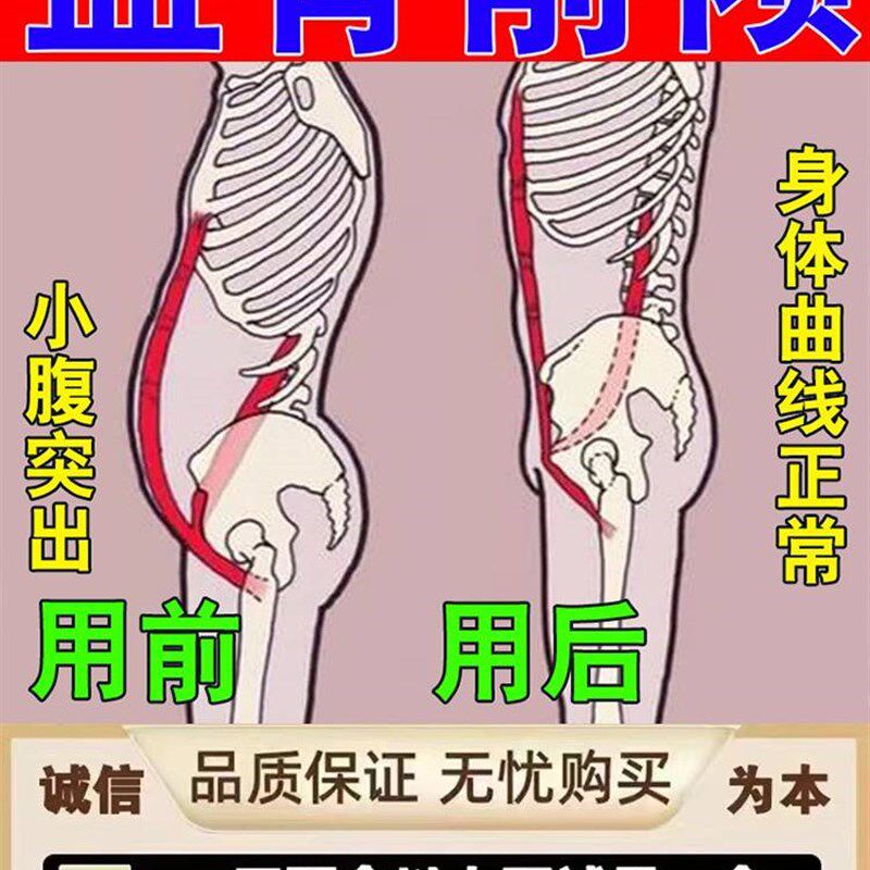 热销骨盆前倾假胯宽矫正腹直肌分离趾骨小腹凸起产后收胯神器男女