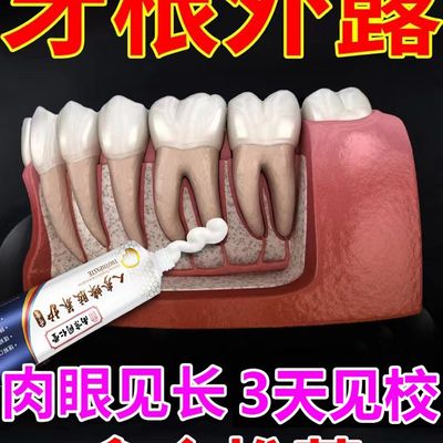 【重度牙龈萎缩】护龈固齿退缩牙齿敏F感正动松畸牙理出血护龈牙