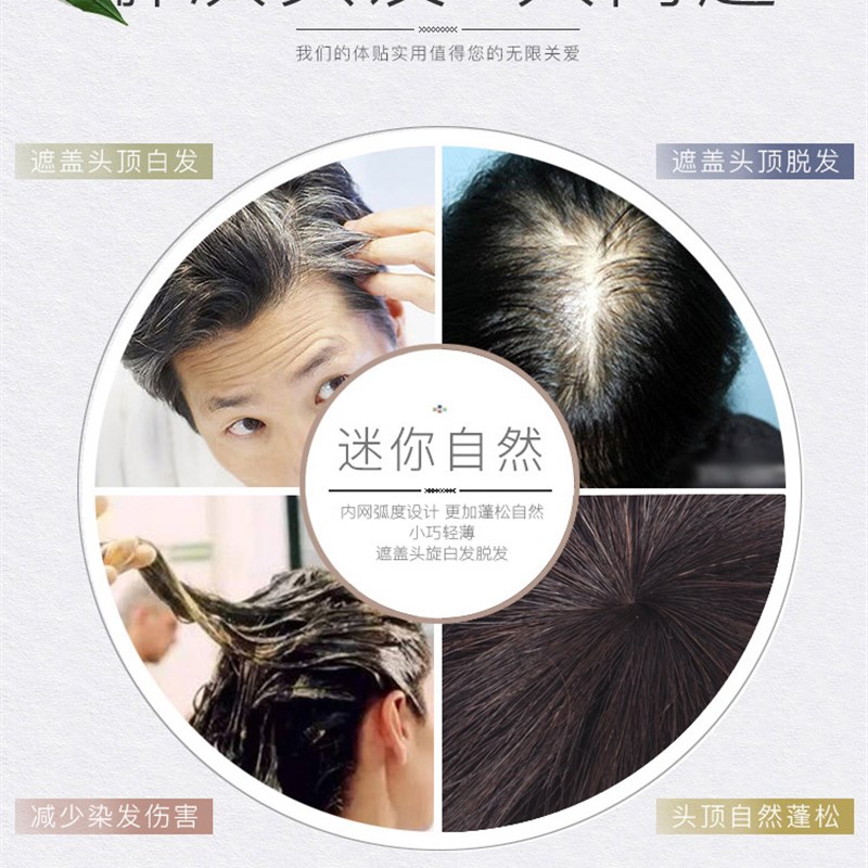 假发片真发头顶补发片女蓬松补发块一片式隐形发顶遮头旋白发