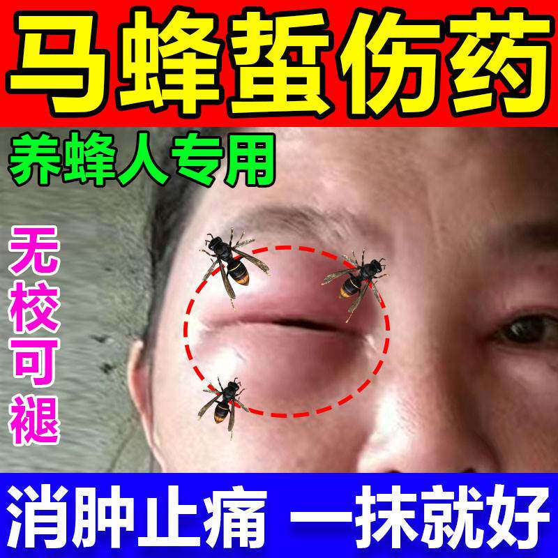 马蜂蛰伤药膏人被马蜂叮咬消肿止痛止痒拔毒杀菌的药养蜂专用工具