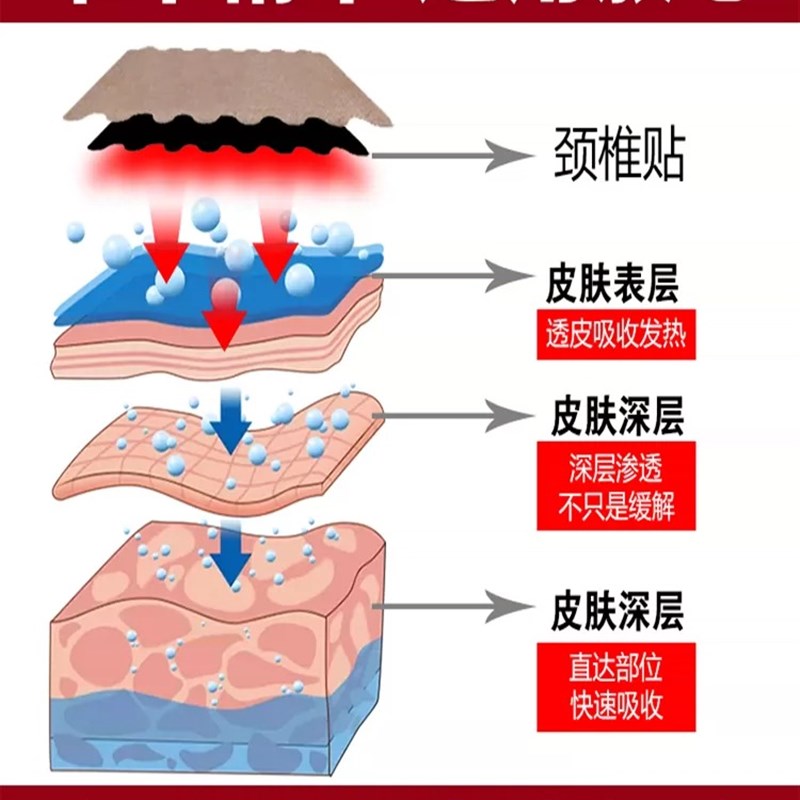 速发【300%管用】重度颈椎病颈椎酸痛颈椎压迫脖子僵硬富贵包专用