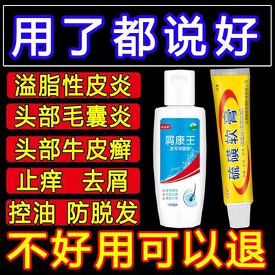 直销头藓药 膏治头部头藓银屑藓头皮屑严重去头皮屑药头痒的去屑