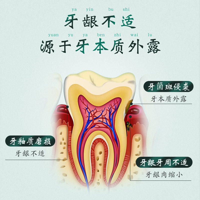 草方牙膏包邮促销防蛀去口臭美z白去黄去牙渍牙龈出血牙膏口气清