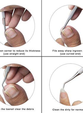 Nail-Clippers Scissors Pedicure Cutter Nails-Tool Long-Handl