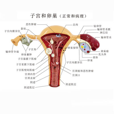 人体女性生殖子宫解剖病理模型 阴道卵巢教学模型S 妇科生殖科教