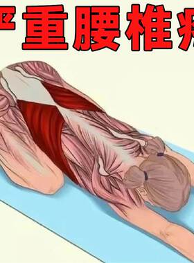 工厂销【腰疼克星】腰椎贴腰w椎突出压迫神经腿脚麻木治腰部劳损