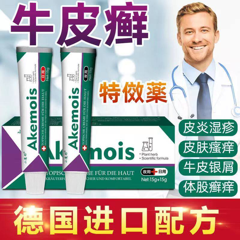 推荐【德国研发】顽固性牛皮癣专用银屑病湿疹体癣手足癣止痒进口