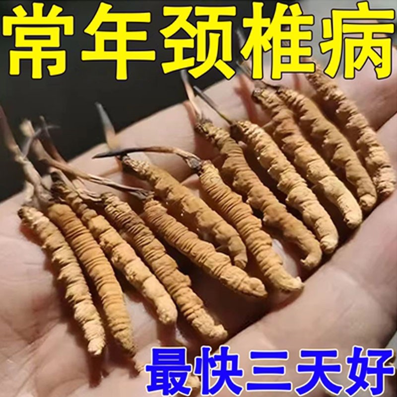 速发三天见好】颈椎贴脖子僵硬转头困难头疼头晕肩颈酸痛颈椎病专